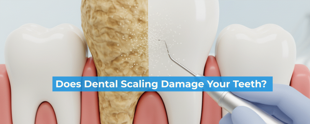 Is professional teeth cleaning truly necessary?"